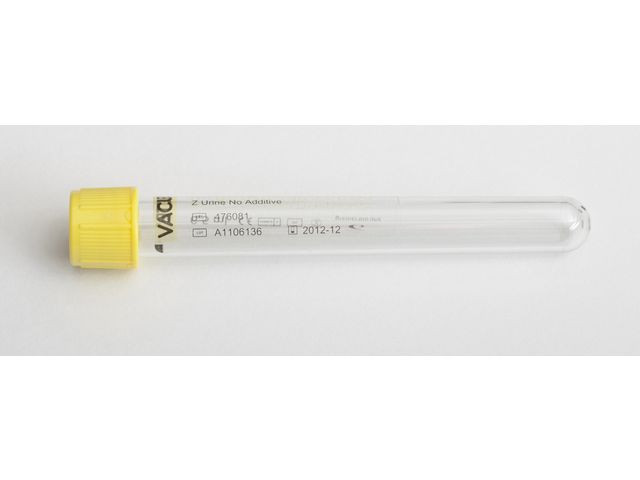 BildeProvrör VACUETTE Gul Urin 7/6,5ml 50/fp